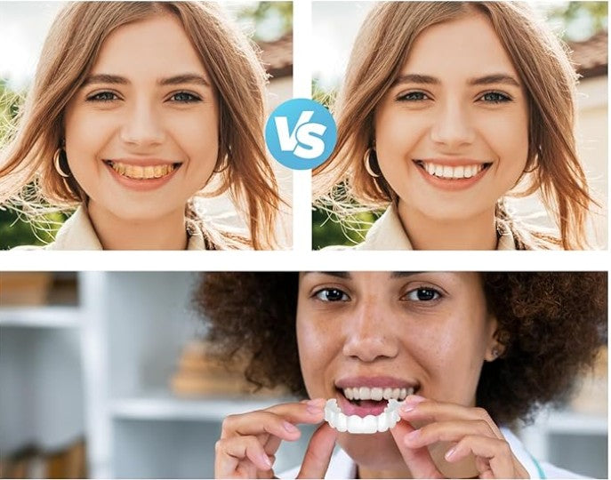 CARILLAS DENTALES Snap-On Smile