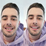 CARILLAS DENTALES Snap-On Smile