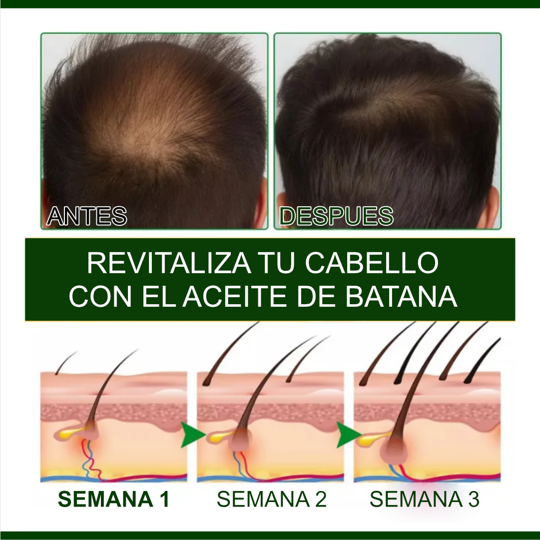 ¿Cabello débil, sin brillo o con caída? Dale fuerza desde la raíz 💥 Aceite de Batana®
