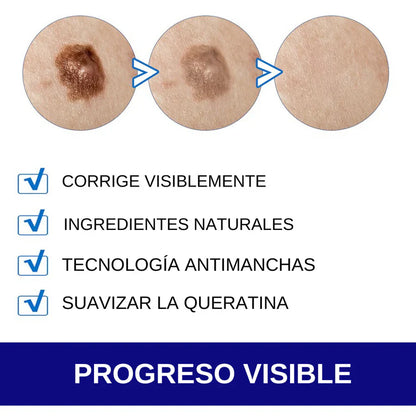 GEL WART REMOVER ELIMINA VERRUGAS, LUNARES Y MANCHAS DE TU PIEL