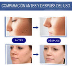 GEL WARTREMOVER ELIMINA VERRUGAS, LUNARES Y MANCHAS DE TU PIEL-TOP EN VENTAS