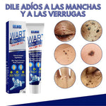 GEL WARTREMOVER ELIMINA VERRUGAS, LUNARES Y MANCHAS DE TU PIEL-TOP EN VENTAS