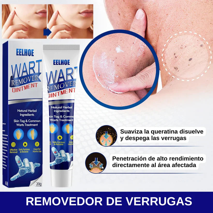GEL WART REMOVER ELIMINA VERRUGAS, LUNARES Y MANCHAS DE TU PIEL