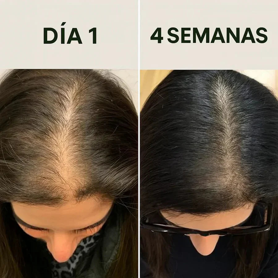 ¿Cabello débil, sin brillo o con caída? Dale fuerza desde la raíz 💥 Aceite de Batana®