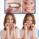 CARILLAS DENTALES Snap-On Smile